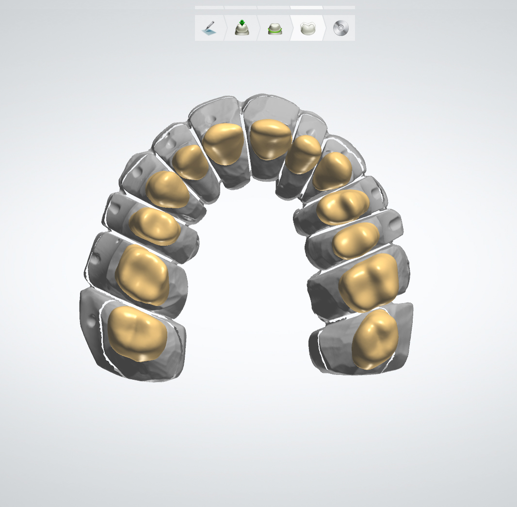 Dental Technology – PakozdyDent